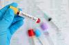 Photo for Global Cholesterol Testing Market 2018-2025 - Industry Trends, Market Size, Segments, Growth Prospects: Data Bridge Market Research