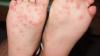 Photo for Foot Care Supplies in Toronto Canada by knowledgeable Staff