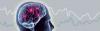 Photo for Brain Monitoring Market Research, Global Analysis, Industry Demand and Forecast 2018-2026