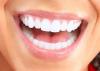 Photo for Where to Get White Braces In Austin, TX