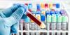 Photo for Blood Screening Market Analysis and Forecast 2025