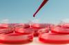 Photo for Global Blood Screening Market: Driven by Increasing Organic Farming across the World