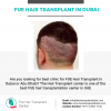 Photo for Fue Hair Transplant In Dubai