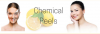 Photo for Chemical Peels Market by Type, Application & End-Users Analysis Report 2018