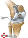 Photo for Orthopaedic Doctor