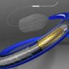 Photo for Neurovascular Devices market Demand, Insight, Analysis, Opportunities, Segmentation