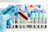 Photo for Clinical Chemistry Analyzers Market worth in USD million by 2024