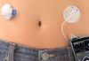Photo for Global Continuous Glucose Monitoring (CGM) Market, By Product Type, By Application, and By Geography - Trends and Forecast to 2024