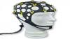 Photo for Adult EEG Cap Market Will Reflect Significant Growth Prospects during 2019 – 2025