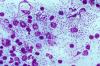 Photo for Global Cytokines Market Rugged Expansion Foreseen by 2022