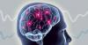 Photo for Brain Monitoring Devices Market by Regional Analysis, Key Players and Forecast 2024
