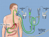 Photo for Enteral Feeding Market 2025: Industry Size Outlook, Increasing Trend Diversity, Analysis, Future Scope