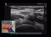 Photo for Portable Vascular Doppler   Market Competitive Dynamics & Global Outlook 2025