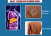 Photo for Graft Versus Host Disease (GvHD) Market – Comprehensive Evaluation Of The Market Via In-Depth Qualitative Insights and future forecast till 2026