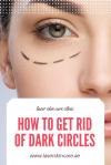 Photo for Dark Circles Removal in Dubai