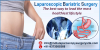 Photo for TOP HOSPITALS BEST SURGEONS FOR AFFORDABLE COST BARIATRIC SURGERY IN INDIA