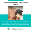 Photo for Body Hair Transplantation in Dubai