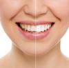 Photo for Connecticut Ave Cosmetic Dentistry