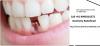 Photo for Best Implant Dentist in Delhi | Dr. Nikhil Sinha