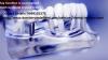 Photo for Fix an Appointment with Implant Dentists in Delhi