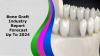 Photo for Bone Graft Market Growth Rate, Developing Trends, Manufacturers, Countries, Product Technology and Application, Global Forecast To 2024