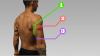 Photo for The 8 Most Effective Triceps Exercises - Endura Gym Supplements