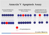 Photo for Transwell Migration and Invasion Assays