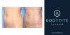 Photo for Find the Best Bodytite Surgery Centers in Fort Worth