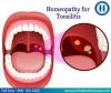 Photo for Homeopathy Treatment For Tonsilitis In Madurai