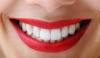 Photo for Six Month Smiles Cosmetic Orthodontics