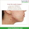 Photo for Homeopathy treatment for skin problems