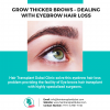 Photo for Grow thicker brows – Dealing with eyebrow hair loss