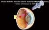 Photo for Global Diabetic Macular Edema Treatment Market Analysis and Forecasts 2018-2025 Market Research report