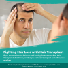 Photo for Fighting hair loss with hair transplant