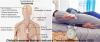 Photo for Global Insomnia Market Industry Analysis, Trends and Forecast to 2025