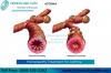 Photo for Cure Asthma With Homeopathy