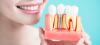 Photo for Dentist in Kochi and Dentures in Cochin