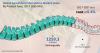 Photo for Spinal Cord Stimulators Market Value is Expected to Increase to US$ 1259.3 Mn by 2027-End