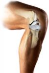 Photo for Knee Implants Market - Global Industry Insights, Trends, Size, Share, Outlook, and Opportunity Analysis, 2018-2026