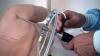 Photo for Arthroscopy Devices Market - Insights, Size, Share, and Forecast till 2025