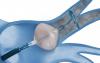 Photo for Global Cryoablation Devices Market Demand and Necessity 2018 to 2026