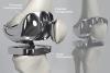 Photo for Joint Replacement Devices Market: Industry Growth, Competitive Analysis, Future Prospects and Forecast 2019