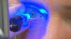 Photo for Global Ophthalmic Lasers Market Expected to Increase at a CAGR 5.0% through 2016 to 2026