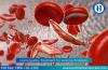 Photo for Homeopathy Treatment For Anemia In Chennai