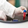 Photo for Lymphocyte Activation Gene - 3 Protein Market Trends Research And Projections For 2018-2026