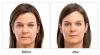 Photo for Helping to sleek the looks of fine lines and wrinkles