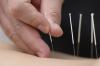 Photo for Anmian Acupuncture