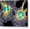 Photo for mouse lung fibroblasts