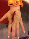 Photo for The Wound Care Devices Market To Grow At A Higher Rate