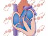 Photo for Coronary Artery Disease Therapeutics Market Will Witness a Staggering Growth During 2018-2026
